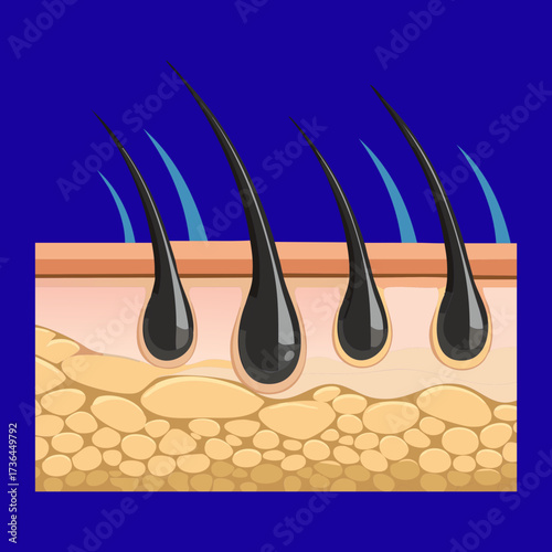 Cross-section diagram showing multiple healthy hair follicles and the root bulb deep within the skin layers