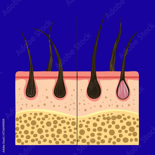  Educational vector graphic depicting the detailed anatomy of hair follicles within the dermis and epidermis layers of skin