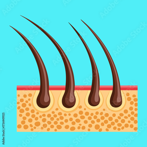 Detailed diagram illustrating the healthy cross-section of human skin showing multiple hair follicles and root structure clearly