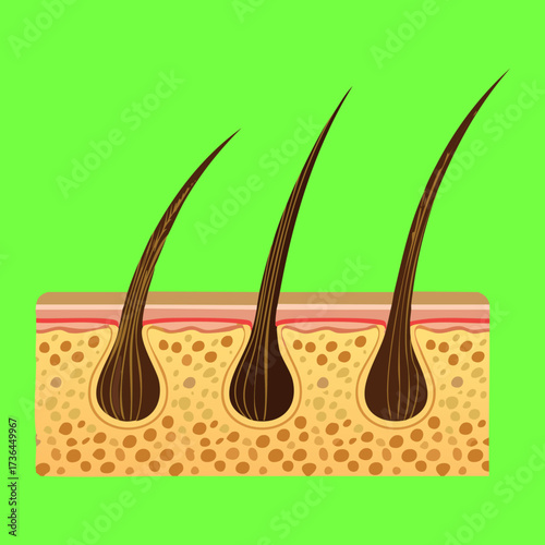  Simplified cross-section graphic of thin hair follicles and their roots within the skin layers for medical education purposes