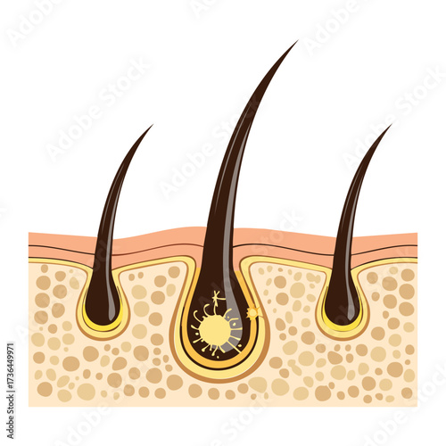 Hair Follicles with Dirt and Bacteria Accumulation at the Base, Indicating Poor Hygiene and Scalp Health Issues	