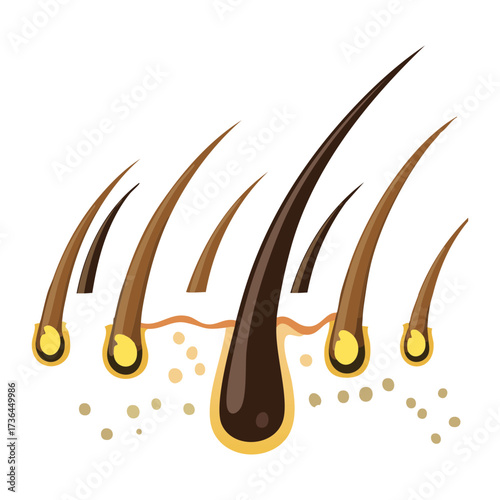 Illustration of Hair Follicles Shedding and Falling Out, Representing Telogen Effluvium or Pattern Baldness	