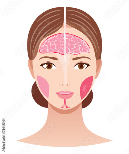 Female Face Illustration Showing Hair Loss and Thinning, Indicating Hormonal Imbalances or Alopecia in Women	