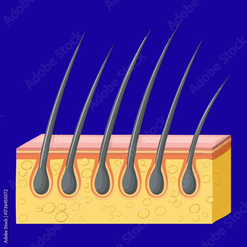 Diagram Showing Numerous Hair Follicles Close Together, Ideal for Explaining Hair Transplant Procedures and Density	
