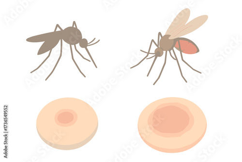Mosquito Bite Illustration. Isometric vector illustration set mosquito proboscis bite itch: insect side silhouette, proboscis
