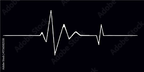 Medical illustration of a green heartbeat cardiogram line on a black monitor showing the pulse and rate of a heart