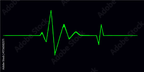 A medical graph of a heartbeat pulse or EKG line on a monitor, often a green wave or blue chart representing health and medicine