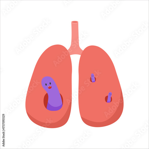 tuberculosis disease, TB bacteria concept