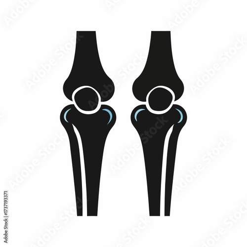 Human knee joint anatomy and cartilage illustration