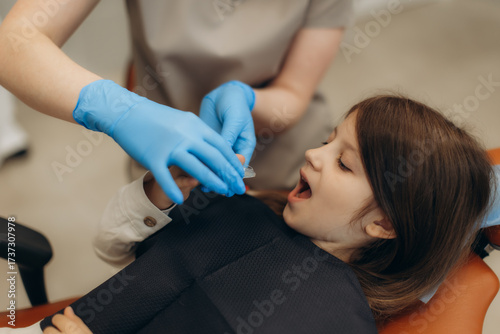 Obraz na plátne Dentist preparing fluoride varnish treatment for little girl in dental clinic