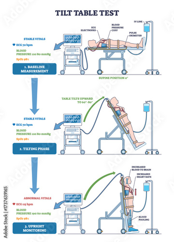 Tilt table test, patient on tilting table with ECG monitor, showing vitals from supine to upright for syncope assessment. Key, table, patient, monitor. Outline diagram