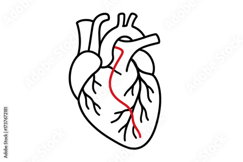 Anatomical human heart outline with a highlighted red path representing a coronary artery