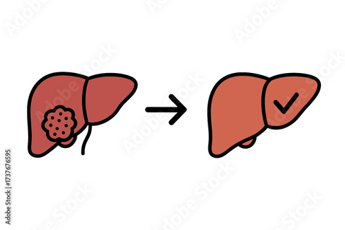 Human liver with tumor transforming to healthy organ, medical concept of disease treatment