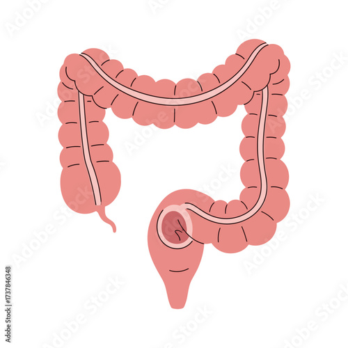 Human colon anatomy isolated on white background, digestive system organ