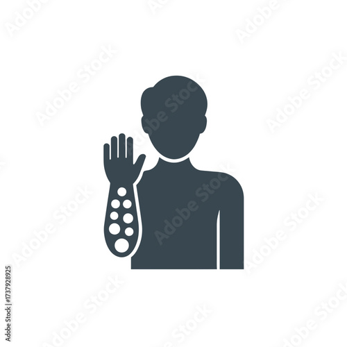 Illustration of a person with a burn injury on their arm receiving treatment