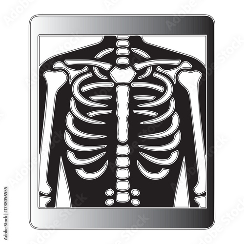X-Ray of Human Ribcage