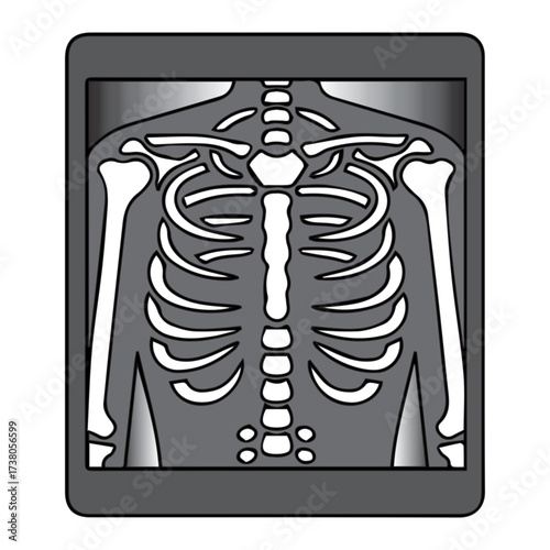 Skeleton X-ray