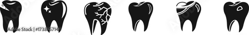 Black dental icons set featuring healthy tooth, cavity, crack, whitening, enamel care, and oral hygiene symbols. Perfect for dental clinic design, logo, or infographic use. Modern flat silhouette