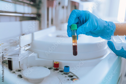 Photos Female laboratory technologist putting test tubes with blood samples in a biochemistry centrifuge analyzer