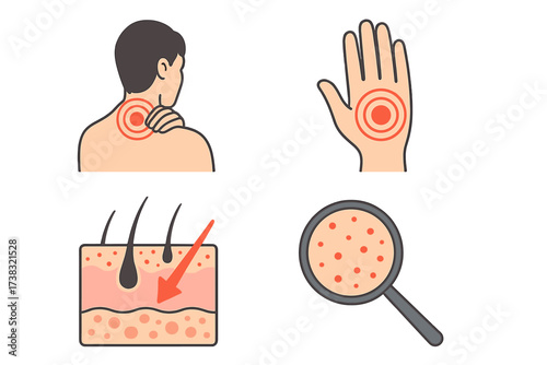 Pain and dermatology icon set. Vector illustrations for neck pain, hand ache, and skin rash. Medical symbols for healthcare, inflammation, body ache, and hair follicle anatomy.