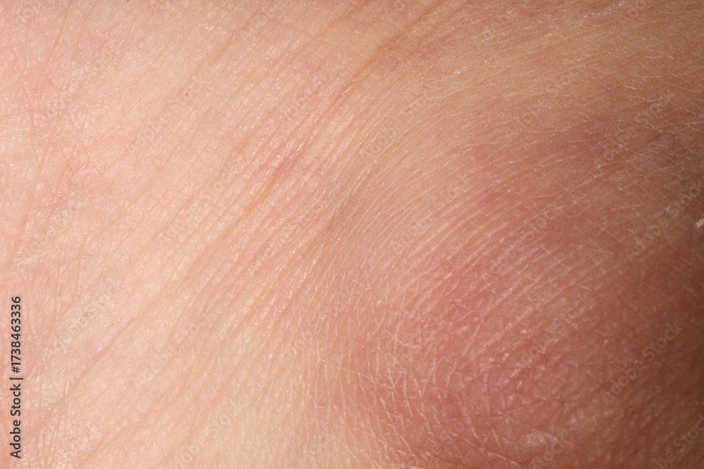 Fototapeta premium Macro view of human skin as background