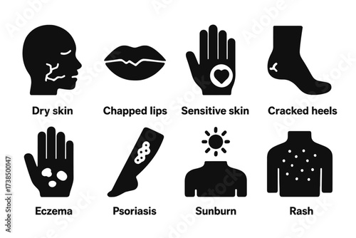 Balm Skin Type Icons. Solid, filled icon set of balm skin types: dry skin, chapped lips, sensitive skin, cracked heels, eczema, psoriasis, sunburn, rash.