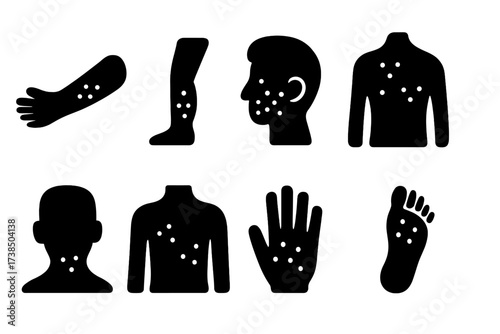 Black Rash Icons. Solid, filled icon set of rash affected areas: arm, leg, face, back, neck, chest, hand, foot. Solid, filled icons in only black color. All