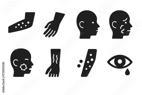 Irritation Symptoms Icons. Solid, filled icon set of irritation symptoms: red rash, itching skin, swelling, dry patches, burning sensation, peeling skin,