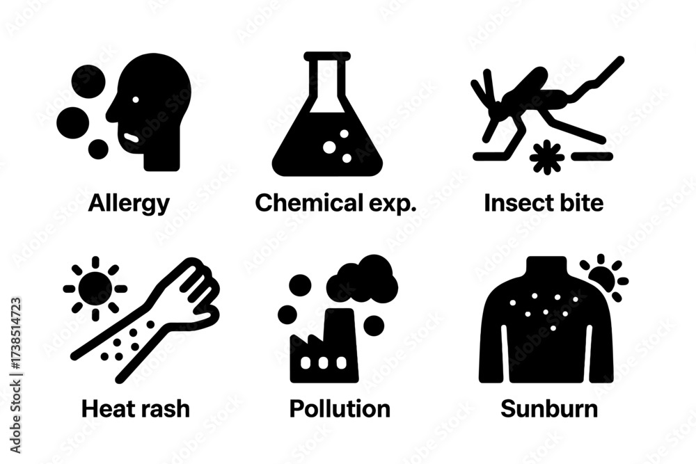 Obraz premium Irritation Causes Icons.