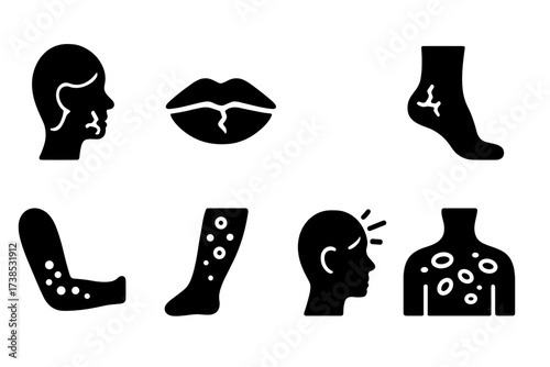 Balm Skin Type Icons. Solid, filled icon set of balm skin types: dry skin, chapped lips, sensitive skin, cracked heels, eczema, psoriasis, sunburn, rash.