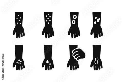 Eczema Symptoms Icons. Solid, filled icon set of eczema symptoms severity: mild rash, severe rash, blistering, cracking, bleeding, scaling, itching, redness.