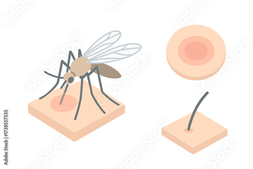 Mosquito Bite Illustration. Isometric vector illustration set mosquito proboscis bite itch: perched mosquito insect, bite welt