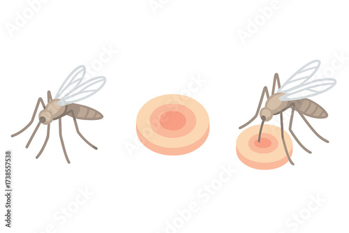 Mosquito Bite Illustration. Isometric vector illustration set mosquito proboscis bite itch: perched mosquito insect, bite welt
