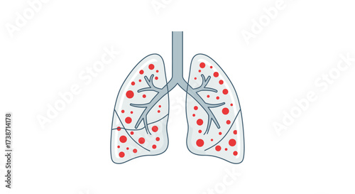 Human lungs illustration showing disease or infection, ideal for medical brochures, healthcare websites, educational materials for respiratory illnesses