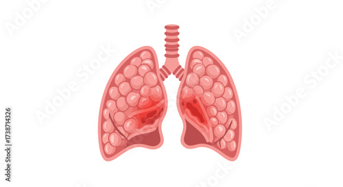 Understanding lung health with detailed anatomical illustrations of healthy alveoli and damaged tissue areas