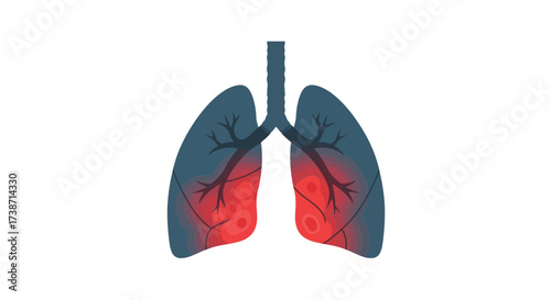 Abstract representation of human lungs showing respiratory distress and inflammation, perfect for medical education and health awareness campaigns