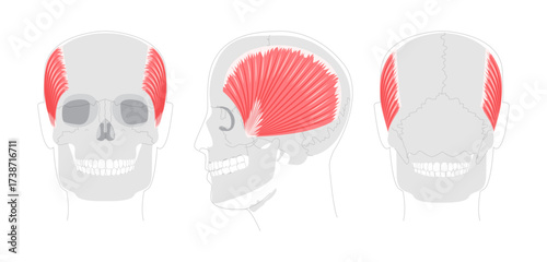 Temporalis - Human jaw muscle displayed in detailed anatomy chart, controls elevation and retraction of the mandible, important for masticatory function and clinical reference