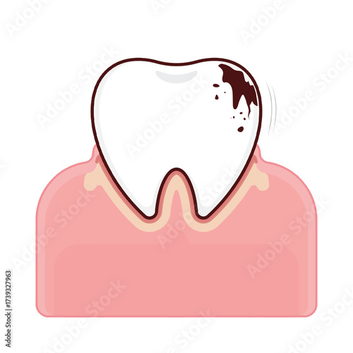 Tooth decay on the gums cartoon cute