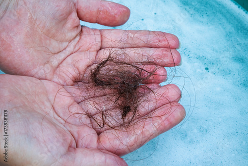 Hair on a woman's white hand after washing her hair in the shower. Alopecia - hair loss problem