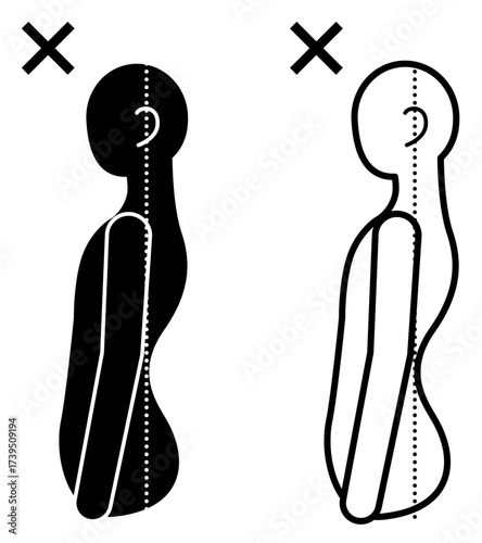 Black and white pictogram of a person with anterior pelvic tilt (swayback), in solid and line art. Includes a median line for spine alignment. Ideal for ergonomics, posture education, workplace health