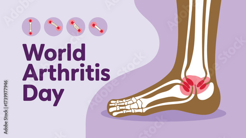 Vector art of world arthritis day graphic featuring a foot and ankle joint, illustrating pain and inflammation with small icons, promoting awareness for joint health