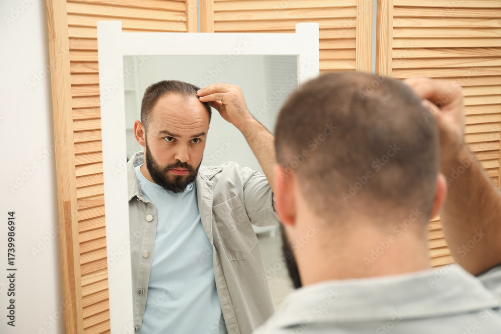Fototapeta premium Baldness problem. Man with receding hairline near mirror at home