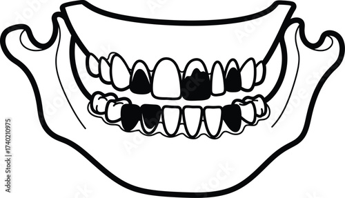 Cartoon jaw with teeth showing decay and dental problems