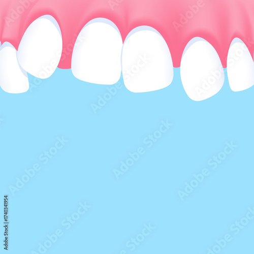 Upper teeth (Crooked) - Text box banner (square) illustration vector design. Dental care concept.