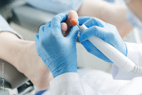 Foto Closeup hand of Podiatrist performing foot treatment on patient