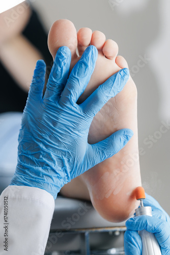 Schilderij op canvas Podiatrist treating patient foot with blue gloves and tool, pedicure callus poli