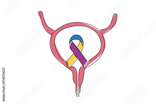 Continuous one line drawing bladder and ribbon bladder cancer awareness campaign. The cry that this cancer is real. Sharing. Bladder Cancer Awareness Day. Single line draw design vector illustration