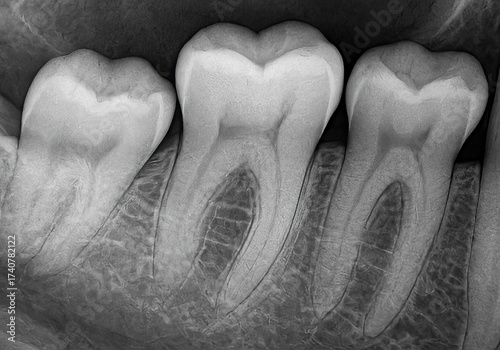 Generative AI: X-Ray of Adult Human Teeth
