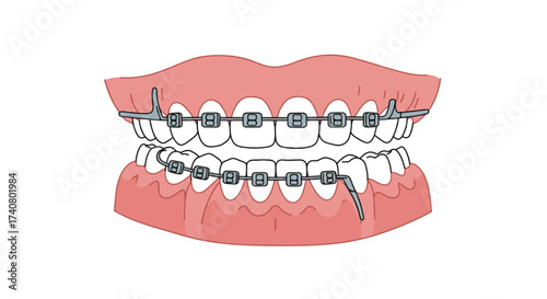 Orthodontic Braces on Teeth, Dental Mouth Vector Line Art Diagram
