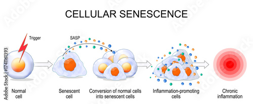 Cellular senescence. Chronic inflammation